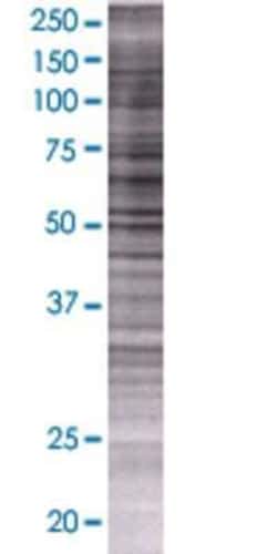 Novus Biologicals Arylsulfatase G/ARSG 293T Cell Transient Overexpression Lysate 0.1 mL | Buy Online | Novus Biologicals&trade; | Fisher Scientific