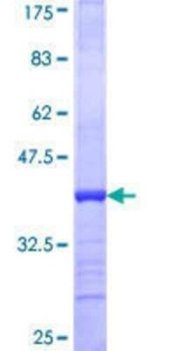 Novus Biologicals Recombinant Human Epsin-2 GST (N-Term) Protein 25 &mu;g | Buy Online | Novus Biologicals&trade; | Fisher Scientific