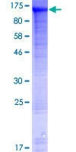 Novus Biologicals Recombinant Human WDR47 GST (N-Term) Protein 10 &mu;g | Buy Online | Novus Biologicals&trade; | Fisher Scientific