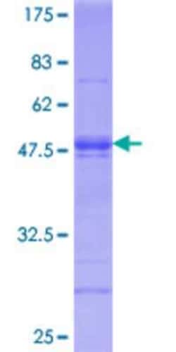 Novus Biologicals Recombinant Human ATF6 GST (N-Term) Protein 25 &mu;g | Buy Online | Novus Biologicals&trade; | Fisher Scientific
