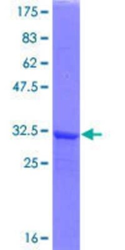 Novus Biologicals Recombinant Human SEPHS2 GST (N-Term) Protein 25 &mu;g | Buy Online | Novus Biologicals&trade; | Fisher Scientific