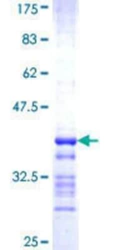 Novus Biologicals Recombinant Human SEPHS2 GST (N-Term) Protein 10 &mu;g | Buy Online | Novus Biologicals&trade; | Fisher Scientific