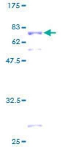 Novus Biologicals Recombinant Human SEPHS1 GST (N-Term) Protein 25 &mu;g | Buy Online | Novus Biologicals&trade; | Fisher Scientific