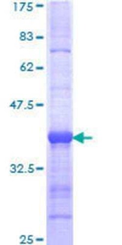 Novus Biologicals Recombinant Human ELL2 GST (N-Term) Protein 10 &mu;g | Buy Online | Novus Biologicals&trade; | Fisher Scientific