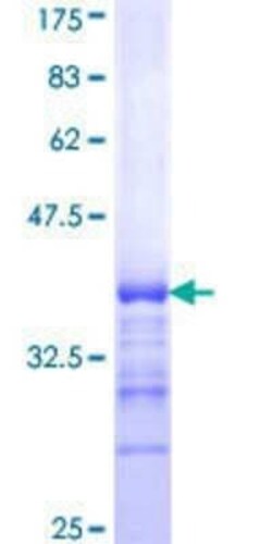 Novus Biologicals Recombinant Human SHANK2 GST (N-Term) Protein 10 &mu;g | Buy Online | Novus Biologicals&trade; | Fisher Scientific