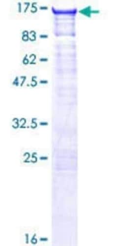 Novus Biologicals Recombinant Human Kanadaptin GST (N-Term) Protein 10 &mu;g | Buy Online | Novus Biologicals&trade; | Fisher Scientific
