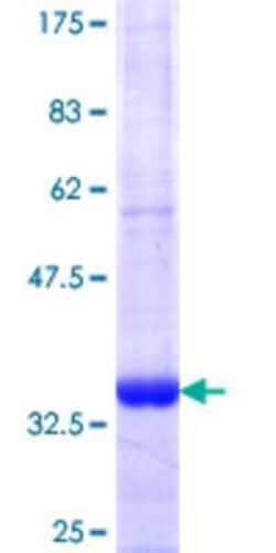 Novus Biologicals Recombinant Human P2X2/P2RX2 GST (N-Term) Protein 25 &mu;g | Buy Online | Novus Biologicals&trade; | Fisher Scientific