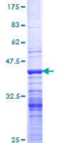 Novus Biologicals Recombinant Human Acinus GST (N-Term) Protein 2 &mu;g | Buy Online | Novus Biologicals&trade; | Fisher Scientific