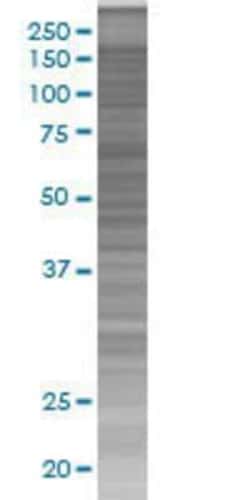 Novus Biologicals&trade;&nbsp;SorCS3 293T Cell Transient Overexpression Lysate