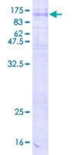 Novus Biologicals Recombinant Human SV2C GST (N-Term) Protein 2 &mu;g | Buy Online | Novus Biologicals&trade; | Fisher Scientific