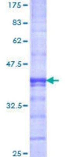 Novus Biologicals Recombinant Human KDM2A/FBXL11 GST (N-Term) Protein 10 &mu;g | Buy Online | Novus Biologicals&trade; | Fisher Scientific