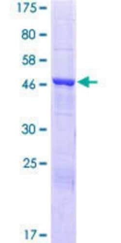 Novus Biologicals Recombinant Human TTC39A GST (N-Term) Protein 25 &mu;g | Buy Online | Novus Biologicals&trade; | Fisher Scientific