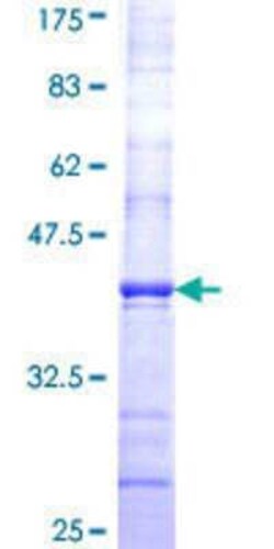 Novus Biologicals Recombinant Human DAAM1 GST (N-Term) Protein 25 &mu;g | Buy Online | Novus Biologicals&trade; | Fisher Scientific