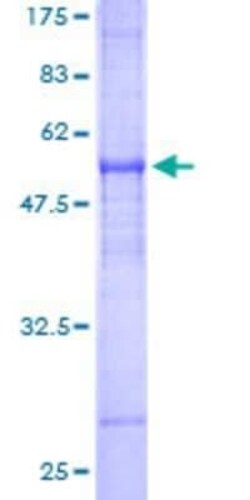 Novus Biologicals Recombinant Human FAIM2 GST (N-Term) Protein 25 &mu;g | Buy Online | Novus Biologicals&trade; | Fisher Scientific