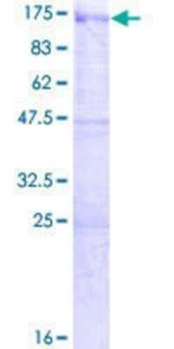 Novus Biologicals Recombinant Human USP33 GST (N-Term) Protein 2 &mu;g | Buy Online | Novus Biologicals&trade; | Fisher Scientific