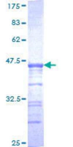 Novus Biologicals Recombinant Human USP33 GST (N-Term) Protein 25 &mu;g | Buy Online | Novus Biologicals&trade; | Fisher Scientific