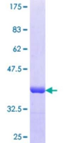 Novus Biologicals Recombinant Human SAMD4A GST (N-Term) Protein 25 &mu;g | Buy Online | Novus Biologicals&trade; | Fisher Scientific