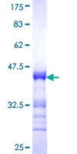 Novus Biologicals Recombinant Human MYT1L GST (N-Term) Protein 25 &mu;g | Buy Online | Novus Biologicals&trade; | Fisher Scientific
