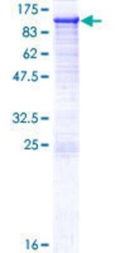 Novus Biologicals Recombinant Human PDXDC1 GST (N-Term) Protein 10 &mu;g | Buy Online | Novus Biologicals&trade; | Fisher Scientific