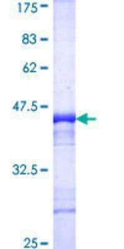 Novus Biologicals Recombinant Human TNIK GST (N-Term) Protein 25 &mu;g | Buy Online | Novus Biologicals&trade; | Fisher Scientific