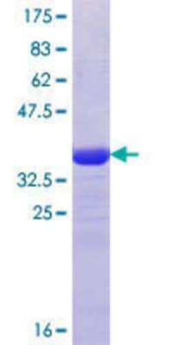 Novus Biologicals Recombinant Human KIF21B GST (N-Term) Protein 25 &mu;g | Buy Online | Novus Biologicals&trade; | Fisher Scientific