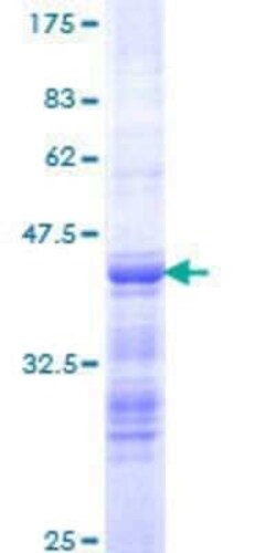 Novus Biologicals Recombinant Human APRIN GST (N-Term) Protein 25 &mu;g | Buy Online | Novus Biologicals&trade; | Fisher Scientific