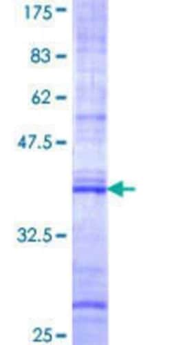 Novus Biologicals Recombinant Human FNBP1 GST (N-Term) Protein 10 &mu;g | Buy Online | Novus Biologicals&trade; | Fisher Scientific