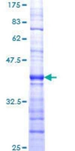 Novus Biologicals Recombinant Human SMG1 GST (N-Term) Protein 25 &mu;g | Buy Online | Novus Biologicals&trade; | Fisher Scientific