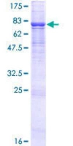 Novus Biologicals Recombinant Human ENDOD1 GST (N-Term) Protein 25 &mu;g | Buy Online | Novus Biologicals&trade; | Fisher Scientific