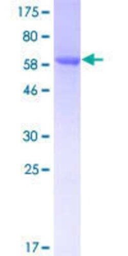 Novus Biologicals Recombinant Human CLUAP1 GST (N-Term) Protein 10 &mu;g | Buy Online | Novus Biologicals&trade; | Fisher Scientific
