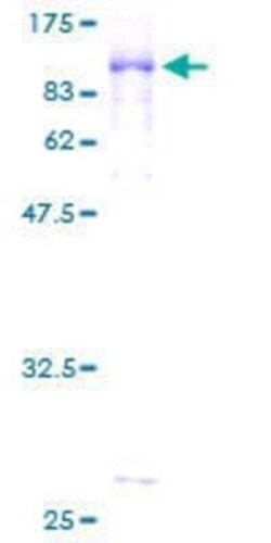 Novus Biologicals Recombinant Human GGA2 GST (N-Term) Protein 10 &mu;g | Buy Online | Novus Biologicals&trade; | Fisher Scientific