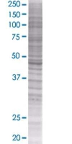 Novus Biologicals WAPL 293T Cell Transient Overexpression Lysate 0.1 mL | Buy Online | Novus Biologicals&trade; | Fisher Scientific