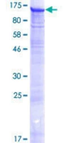 Novus Biologicals Recombinant Human FTSJD2 GST (N-Term) Protein 25 &mu;g | Buy Online | Novus Biologicals&trade; | Fisher Scientific