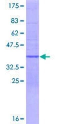 Novus Biologicals Recombinant Human ELKS GST (N-Term) Protein 10 &mu;g | Buy Online | Novus Biologicals&trade; | Fisher Scientific