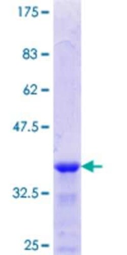 Novus Biologicals Recombinant Human ELKS GST (N-Term) Protein 10 &mu;g | Buy Online | Novus Biologicals&trade; | Fisher Scientific