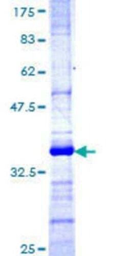 Novus Biologicals Recombinant Human TRIM35 GST (N-Term) Protein 25 &mu;g | Buy Online | Novus Biologicals&trade; | Fisher Scientific