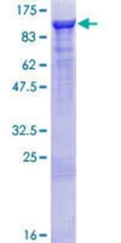 Novus Biologicals Recombinant Human GRAF GST (N-Term) Protein 10 &mu;g | Buy Online | Novus Biologicals&trade; | Fisher Scientific