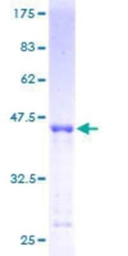 Novus Biologicals Recombinant Human MRPS27 GST (N-Term) Protein 25 &mu;g | Buy Online | Novus Biologicals&trade; | Fisher Scientific