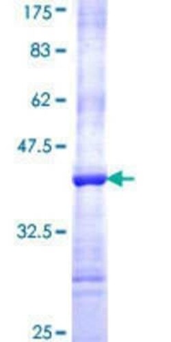 Novus Biologicals Recombinant Human HIC2 GST (N-Term) Protein 2 &mu;g | Buy Online | Novus Biologicals&trade; | Fisher Scientific
