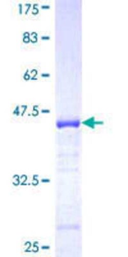 Novus Biologicals Recombinant Human EPB41L3 GST (N-Term) Protein 25 &mu;g | Buy Online | Novus Biologicals&trade; | Fisher Scientific