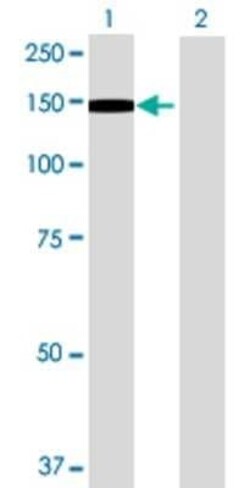 Novus Biologicals EPB41L3 293T Cell Transient Overexpression Lysate 0.1 mL | Buy Online | Novus Biologicals&trade; | Fisher Scientific