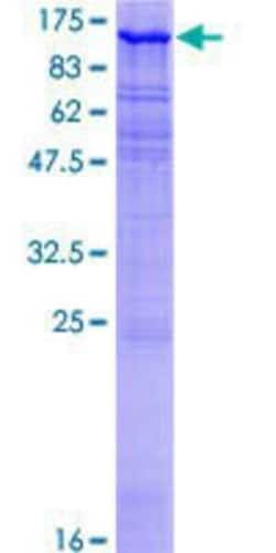 Novus Biologicals Recombinant Human MAST205 GST (N-Term) Protein 10 &mu;g | Buy Online | Novus Biologicals&trade; | Fisher Scientific