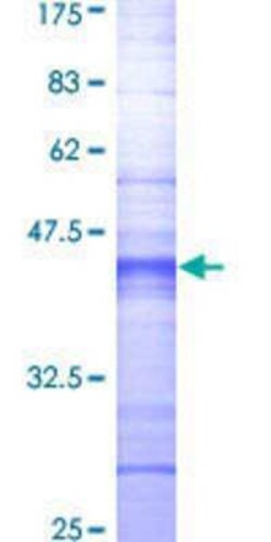 Novus Biologicals Recombinant Human MAST205 GST (N-Term) Protein 2 &mu;g | Buy Online | Novus Biologicals&trade; | Fisher Scientific