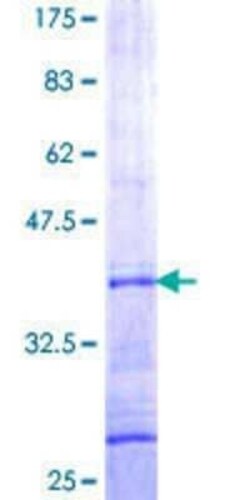 Novus Biologicals Recombinant Human GGA3 GST (N-Term) Protein 10 &mu;g | Buy Online | Novus Biologicals&trade; | Fisher Scientific
