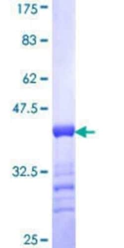 Novus Biologicals Recombinant Human Stabilin-1 GST (N-Term) Protein 25 &mu;g | Buy Online | Novus Biologicals&trade; | Fisher Scientific