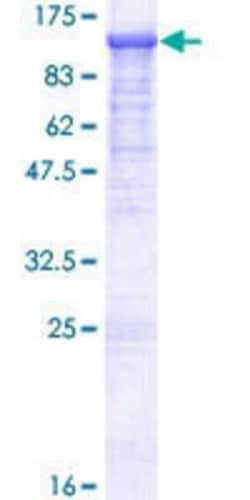 Novus Biologicals Recombinant Human EFR3A GST (N-Term) Protein 25 &mu;g | Buy Online | Novus Biologicals&trade; | Fisher Scientific