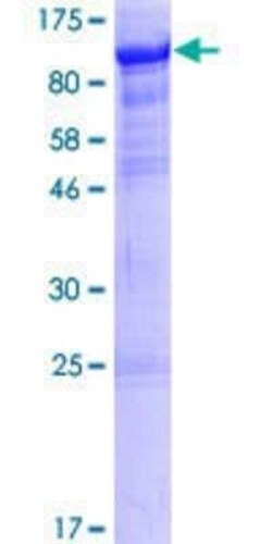 Novus Biologicals Recombinant Human RTF1 GST (N-Term) Protein 25 &mu;g | Buy Online | Novus Biologicals&trade; | Fisher Scientific