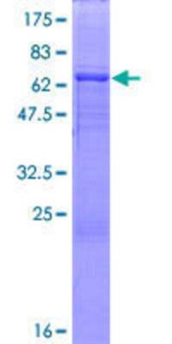 Novus Biologicals&trade;&nbsp;Recombinant Human ABRO GST (N-Term) Protein