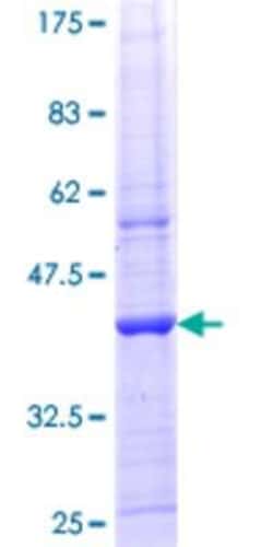 Novus Biologicals&trade;&nbsp;Recombinant Human Lipin 1 GST (N-Term) Protein