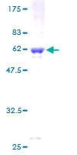 Novus Biologicals Recombinant Human Septin-8 GST (N-Term) Protein 10 &mu;g | Buy Online | Novus Biologicals&trade; | Fisher Scientific